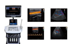 【多維彩超】四維彩超機,三維,二維的彩